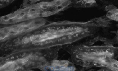 小鼠肾脏荧光图像（单色）的比较 使用传统模型“DS-Ri2”获取图像