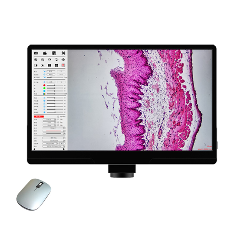 HDP5613带屏一体化相机11.6寸高清显示屏