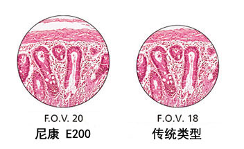 更大视野